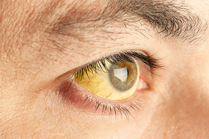 Aguas con la hepatitis C! Aguas con la hepatitis C!