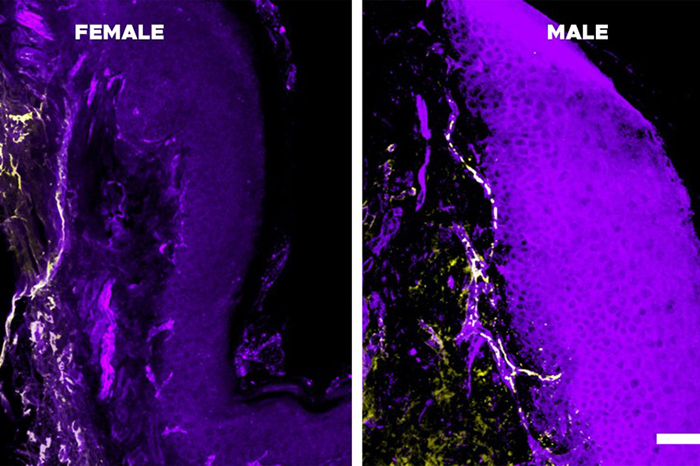 Representación microscópica de monocitos interactuando con neuronas para inhibir señales de dolor.