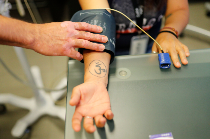 Prototipo de parche transdérmico y arreglo de microagujas desarrollado por investigadores de la UNAM para administrar antihipertensivos.