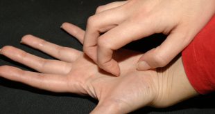 Una persona estresada tocándose el rostro o mostrando irritación en la piel, representando la conexión mente-cuerpo.