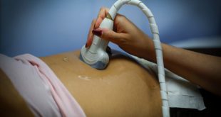 Representación microscópica de células de la placenta humana y modelos de organoides tridimensionales.