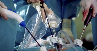 Investigador analizando resultados de un análisis de sangre de antígeno prostático específico (PSA).