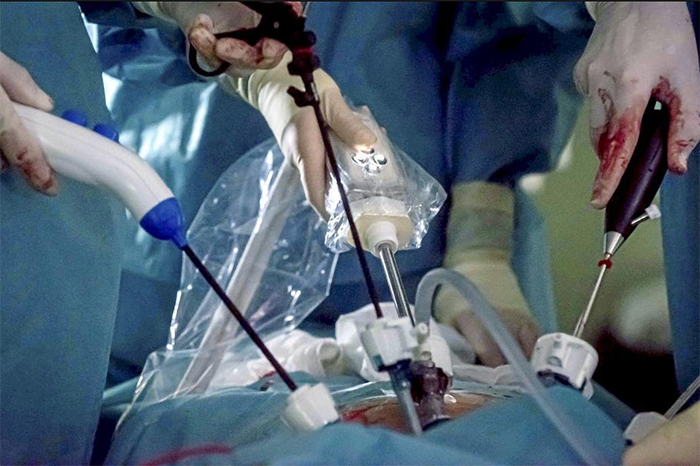 Investigador analizando resultados de un análisis de sangre de antígeno prostático específico (PSA).