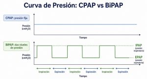 CPAP entrega un único nivel de presión constante durante toda la noche